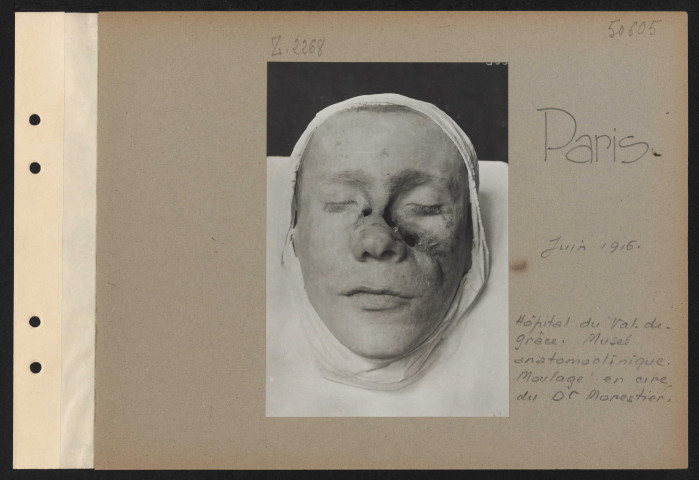 Paris. Hôtel du Val de Grâce. Musée anatomoclinique. Moulages en cire du docteur Morestier