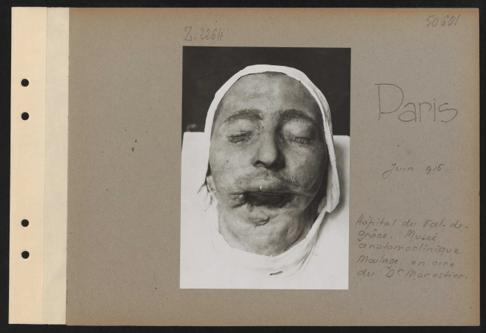 Paris. Hôtel du Val de Grâce. Musée anatomoclinique. Moulages en cire du docteur Morestier