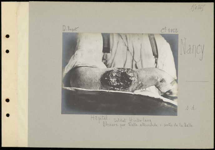 Nancy. Hôpital. Soldat Hinterlang. Blessure par balle allemande : sortie de la balle