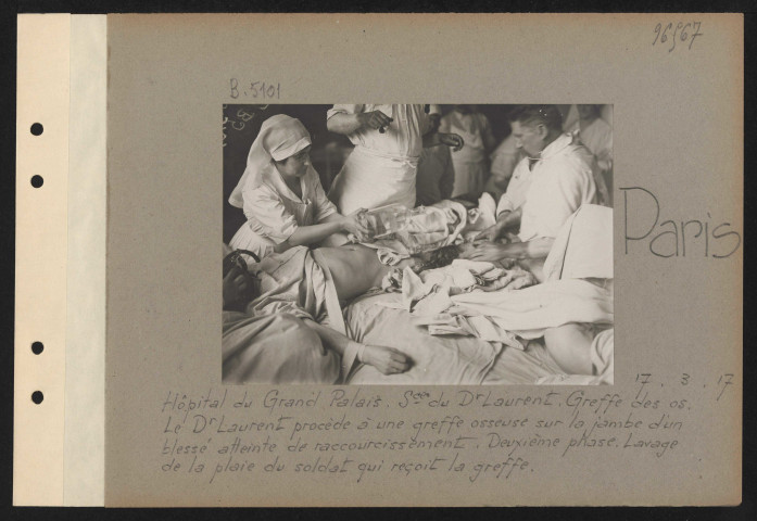 Paris. Hôpital du Grand Palais. Service du docteur Laurent. Greffe des os. Le docteur Laurent procède à une greffe osseuse sur la jambe d'un blessé atteinte de raccourcissement. Deuxième phase. Lavage de la plaie du soldat qui reçoit la greffe